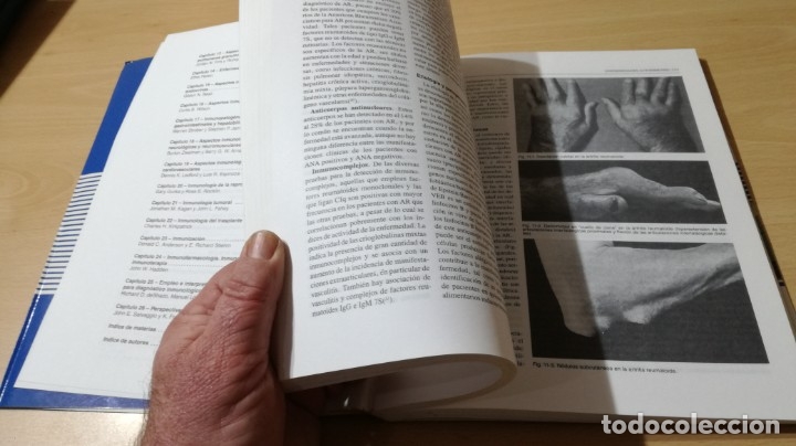 Libros de segunda mano: COMPENDIO DE ENFERMEDADES ALERGICAS E INMUNOLOGICAS - JAMA	 / 	E602 - Foto 11