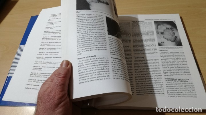 Libros de segunda mano: COMPENDIO DE ENFERMEDADES ALERGICAS E INMUNOLOGICAS - JAMA	 / 	E602 - Foto 12