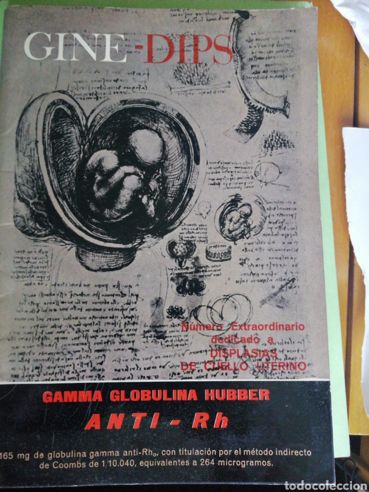 Livres d'occasion: Displasias del Cuello Uterino.Gine Dips. Revista Bimestral Hispano Americana de Obstetricia 1970