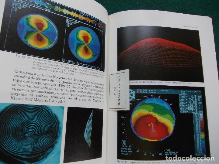 Libros de segunda mano: CIRUGIA REFRACTAREA DE LA CORNEA JOS&Eacute; IGNACIO BARRAQUER M. - Foto 2