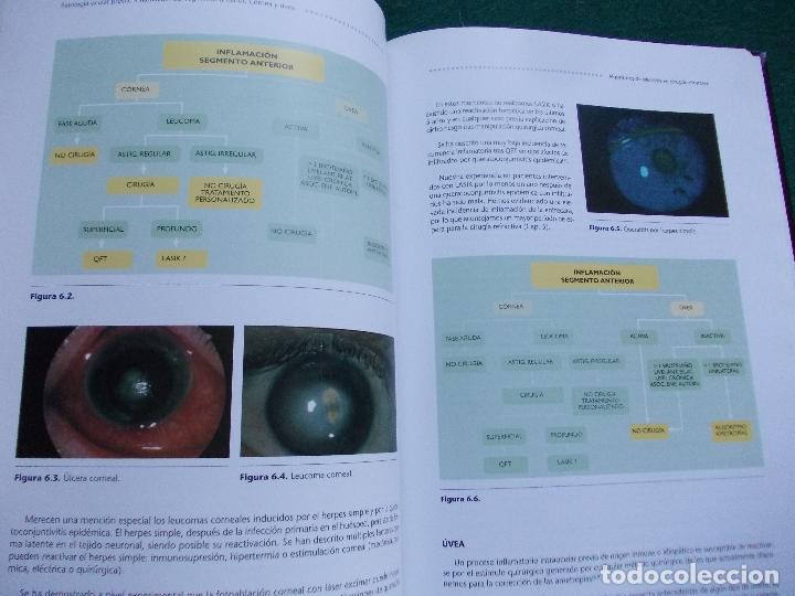 Libros de segunda mano: ALGORITMOS DE DECISI&Oacute;N EN CIRUG&Iacute;A REFRACTIVA - Foto 2