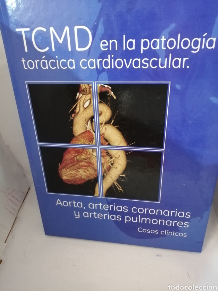 Libri di seconda mano: TCMD EN LA PATOLOGIA TORACICA CARDIOVASCULAR
