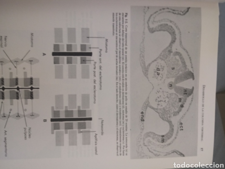 La columna vertebral worksheet