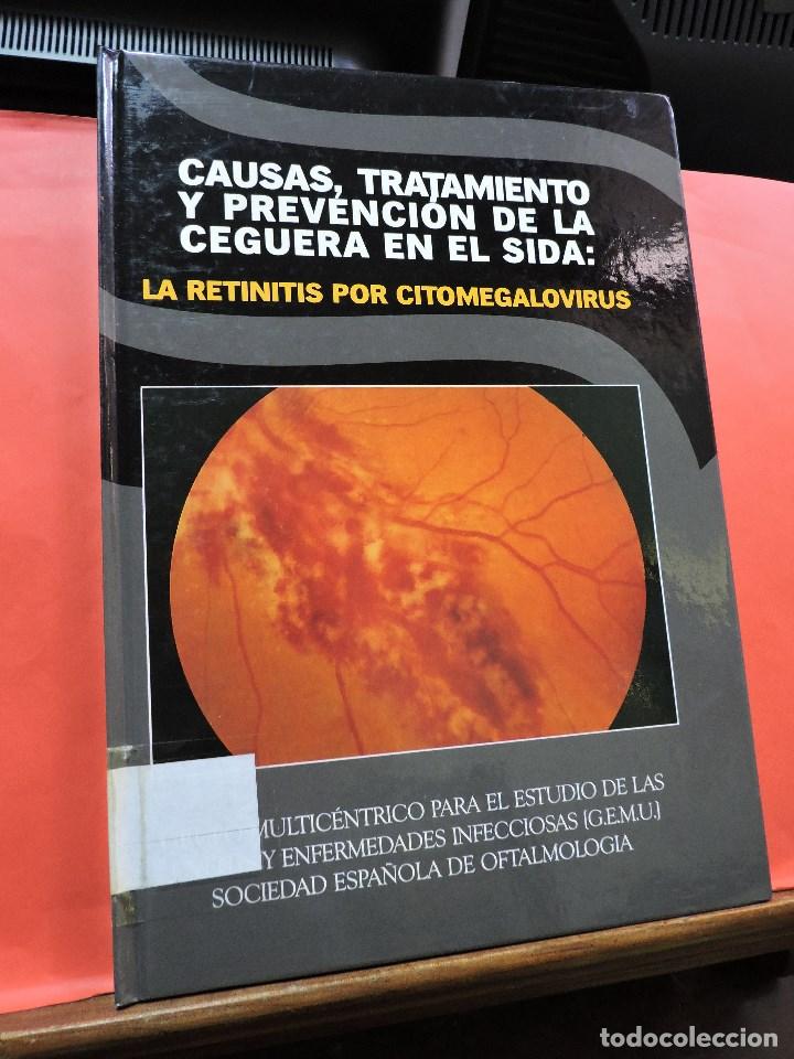 Libri di seconda mano: Causas, tratamiento y prevenci&oacute;n de la ceguera en el sida: Retinitis por citomegalovirus. Ed. SYNTEX
