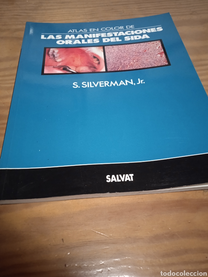 Libri di seconda mano: Las manifestaciones orales del sida. S. Silverman jr