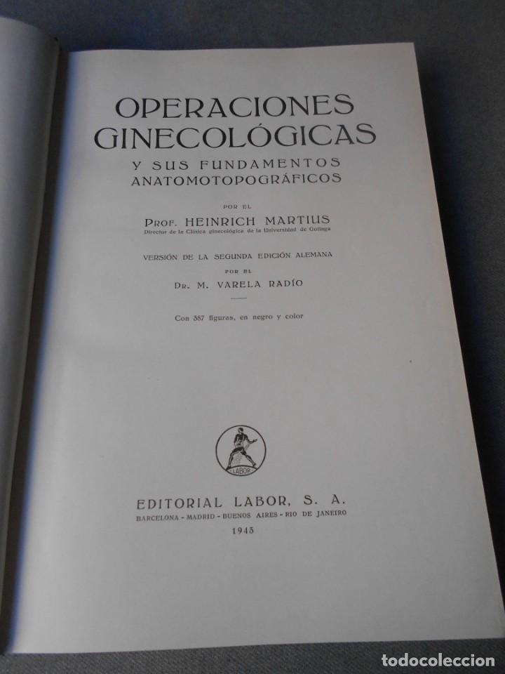 Libros de segunda mano: OPERACIONES GINECOLOGICAS - Foto 2