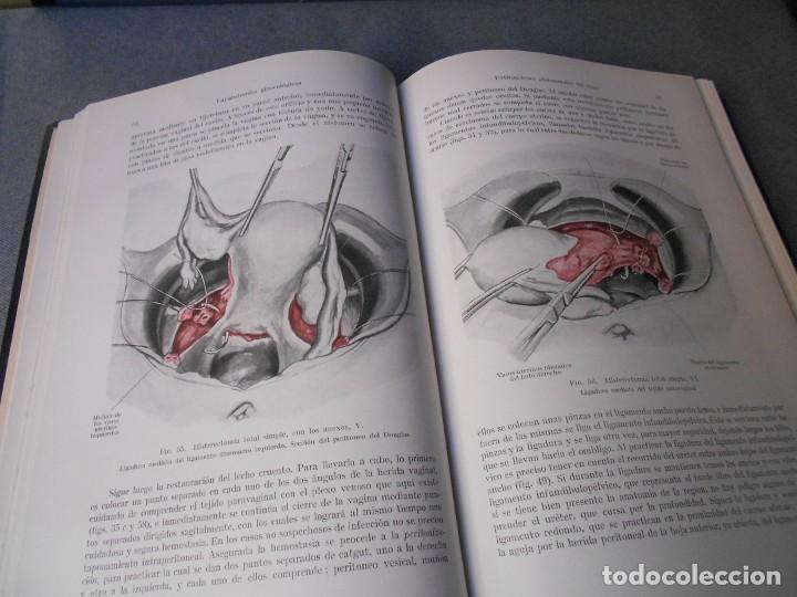 Libros de segunda mano: OPERACIONES GINECOLOGICAS - Foto 3