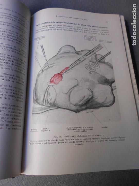 Libros de segunda mano: OPERACIONES GINECOLOGICAS - Foto 4