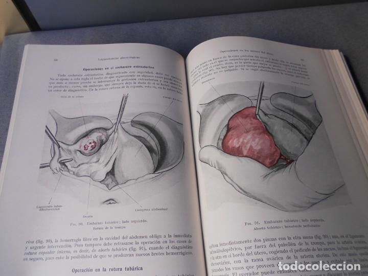 Libros de segunda mano: OPERACIONES GINECOLOGICAS - Foto 6