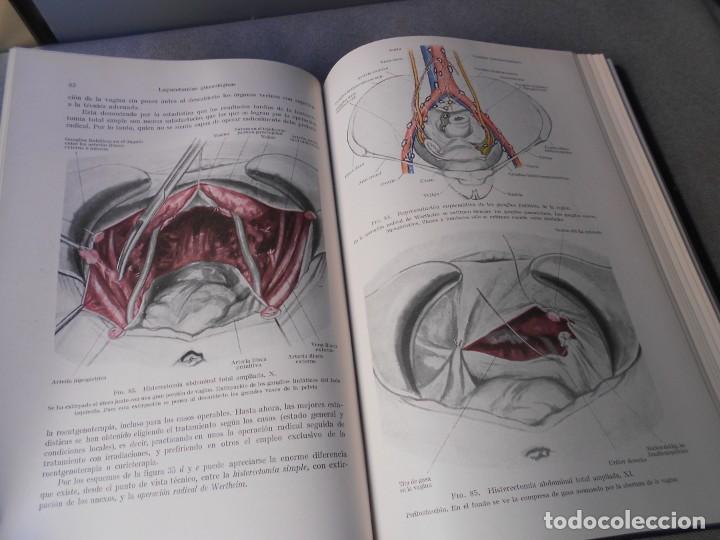 Libros de segunda mano: OPERACIONES GINECOLOGICAS - Foto 7