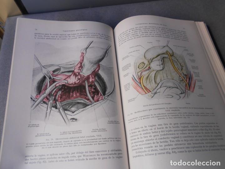 Libros de segunda mano: OPERACIONES GINECOLOGICAS - Foto 8