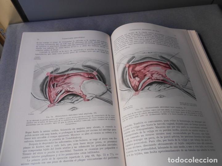 Libros de segunda mano: OPERACIONES GINECOLOGICAS - Foto 9