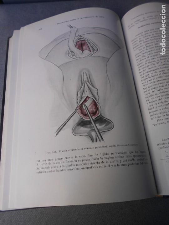Libros de segunda mano: OPERACIONES GINECOLOGICAS - Foto 10