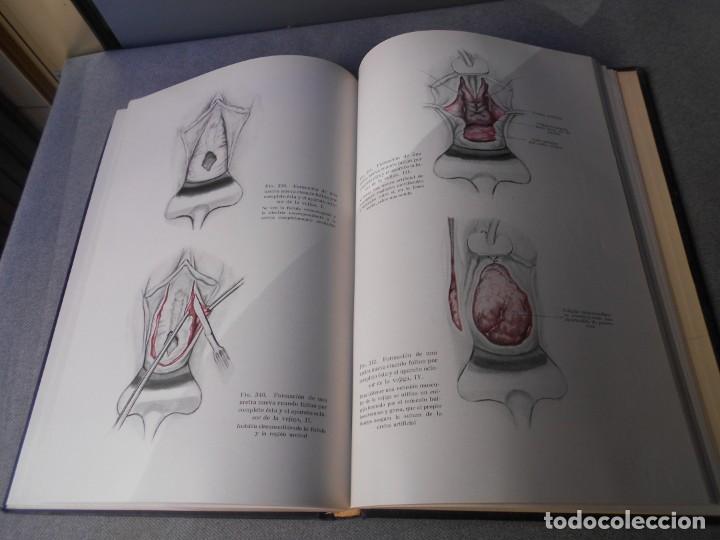 Libros de segunda mano: OPERACIONES GINECOLOGICAS - Foto 11