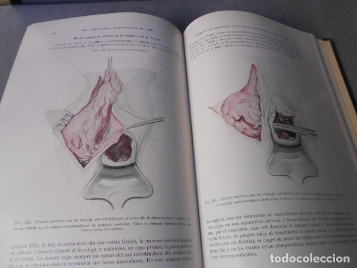Libros de segunda mano: OPERACIONES GINECOLOGICAS - Foto 12