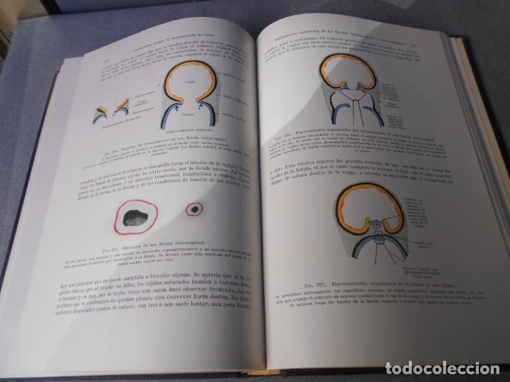 Libros de segunda mano: OPERACIONES GINECOLOGICAS - Foto 13