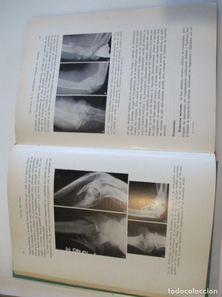 Libros de segunda mano: F.M. SMITH Cirug&iacute;a del codo W4998 - Foto 2