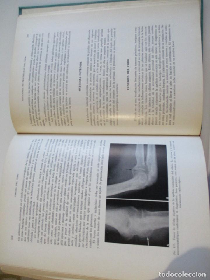 Libros de segunda mano: F.M. SMITH Cirug&iacute;a del codo W4998 - Foto 3