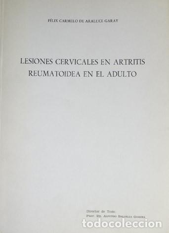 Livres d'occasion: ARALUCE GARAY, F&eacute;lix. Lesiones cervicales en artritis reumatoidea en el adulto. 1965.