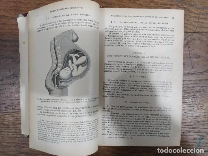 Libros de segunda mano: Manual de Obstetricia - Foto 4