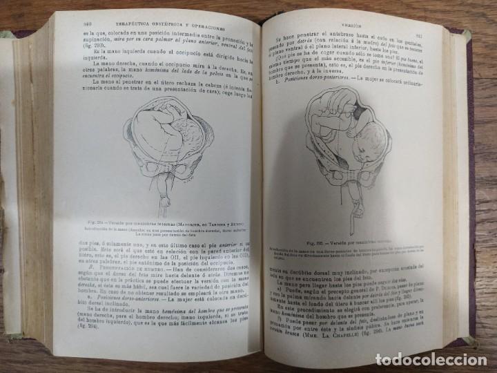 Libros de segunda mano: Manual de Obstetricia - Foto 6