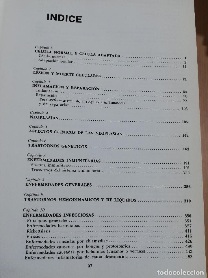 Libros de segunda mano: PATOLOG&Iacute;A ESTRUCTURAL Y FUNCIONAL (DR. STANLEY L. ROBBINS) - Foto 3