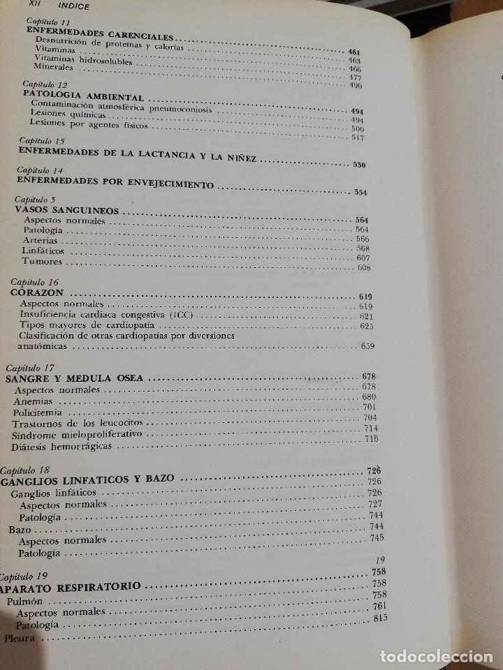 Libros de segunda mano: PATOLOG&Iacute;A ESTRUCTURAL Y FUNCIONAL (DR. STANLEY L. ROBBINS) - Foto 4