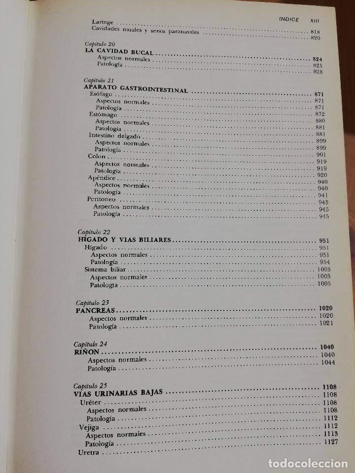 Libros de segunda mano: PATOLOG&Iacute;A ESTRUCTURAL Y FUNCIONAL (DR. STANLEY L. ROBBINS) - Foto 5