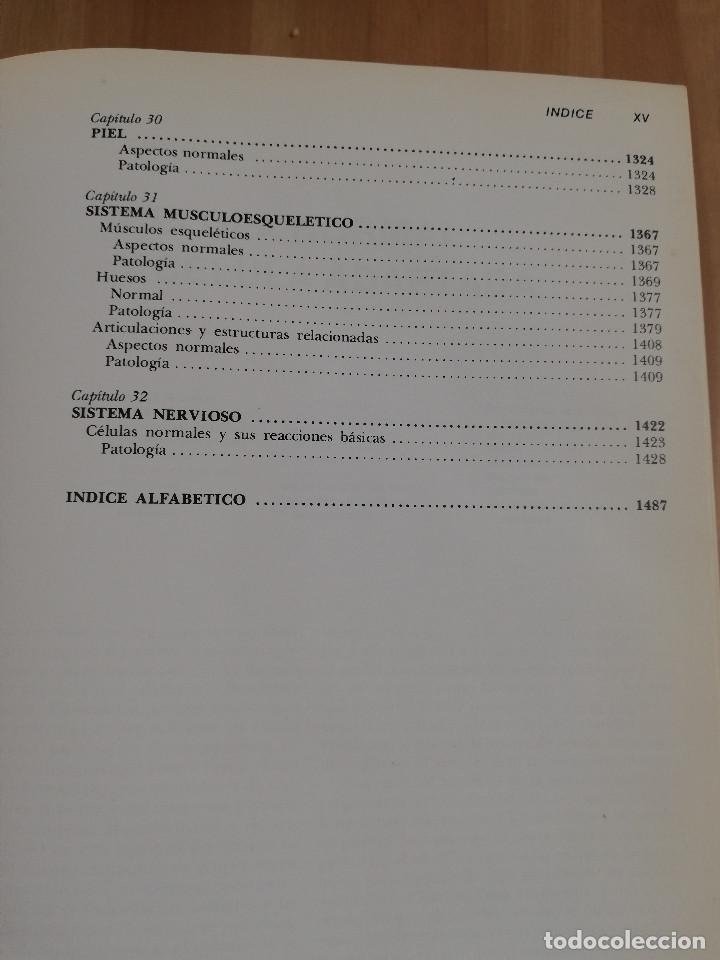 Libros de segunda mano: PATOLOG&Iacute;A ESTRUCTURAL Y FUNCIONAL (DR. STANLEY L. ROBBINS) - Foto 7
