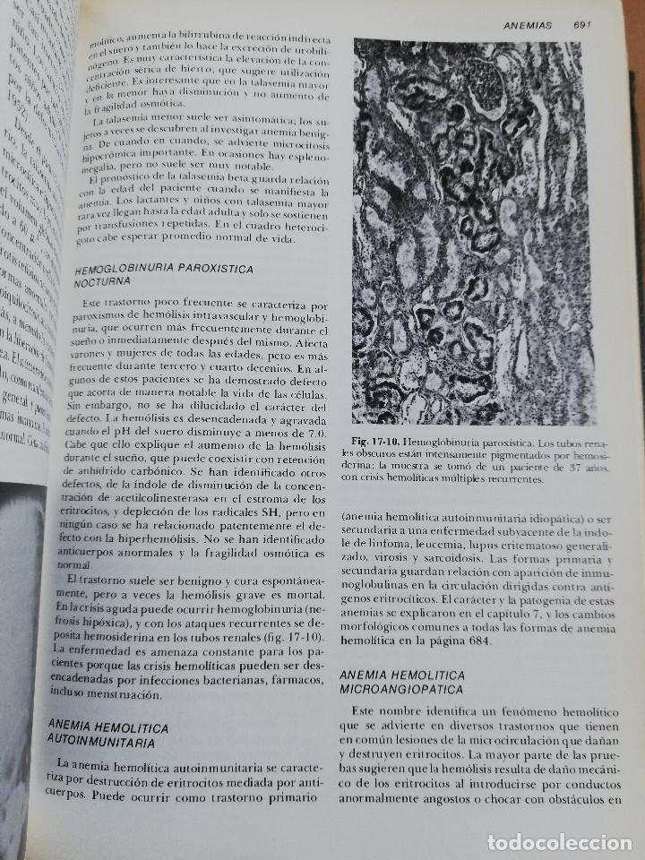 Libros de segunda mano: PATOLOG&Iacute;A ESTRUCTURAL Y FUNCIONAL (DR. STANLEY L. ROBBINS) - Foto 8