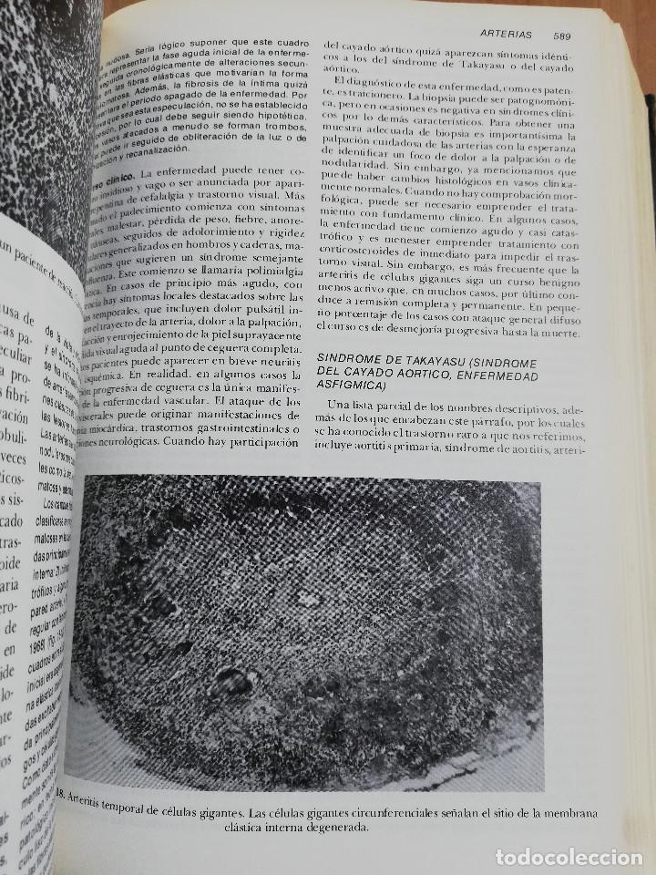 Libros de segunda mano: PATOLOG&Iacute;A ESTRUCTURAL Y FUNCIONAL (DR. STANLEY L. ROBBINS) - Foto 10