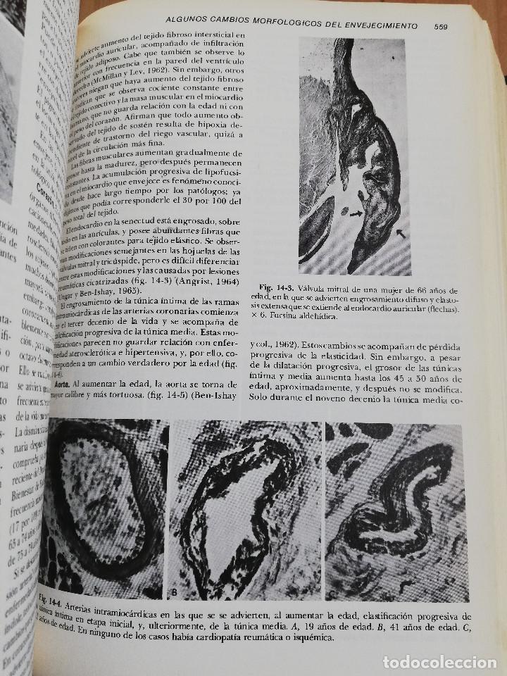 Libros de segunda mano: PATOLOG&Iacute;A ESTRUCTURAL Y FUNCIONAL (DR. STANLEY L. ROBBINS) - Foto 11