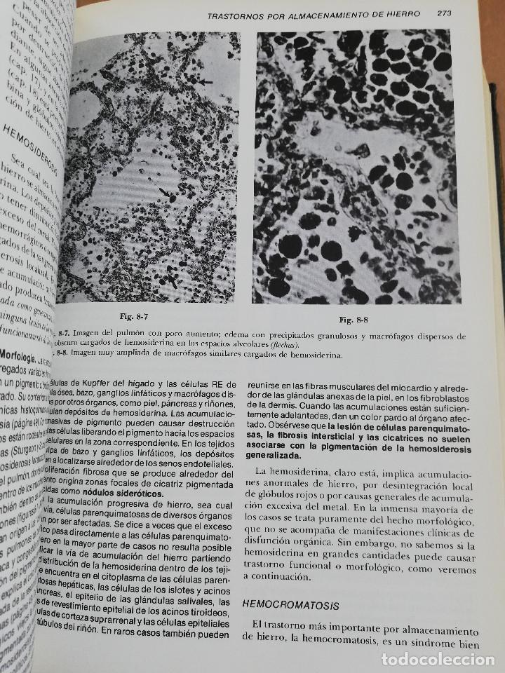 Libros de segunda mano: PATOLOG&Iacute;A ESTRUCTURAL Y FUNCIONAL (DR. STANLEY L. ROBBINS) - Foto 15