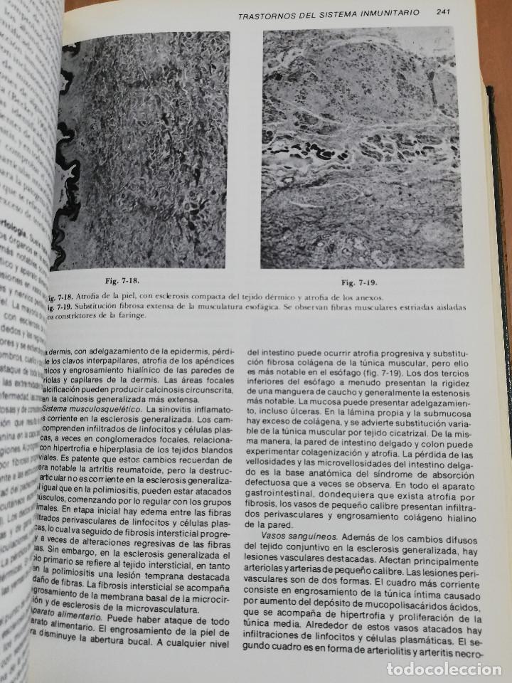 Libros de segunda mano: PATOLOG&Iacute;A ESTRUCTURAL Y FUNCIONAL (DR. STANLEY L. ROBBINS) - Foto 16