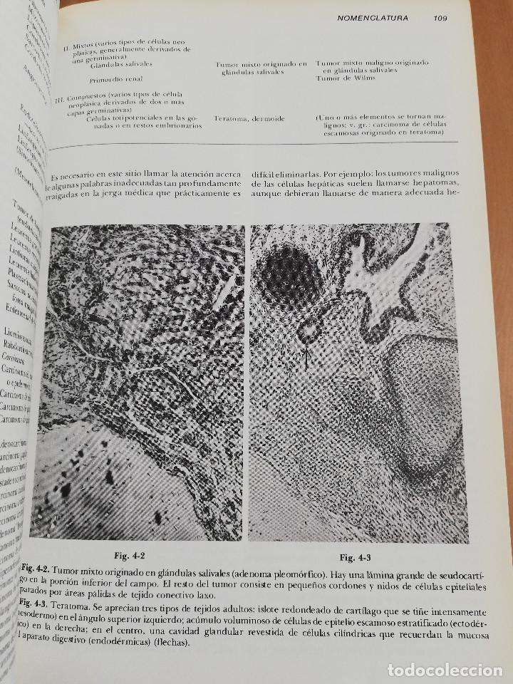 Libros de segunda mano: PATOLOG&Iacute;A ESTRUCTURAL Y FUNCIONAL (DR. STANLEY L. ROBBINS) - Foto 18