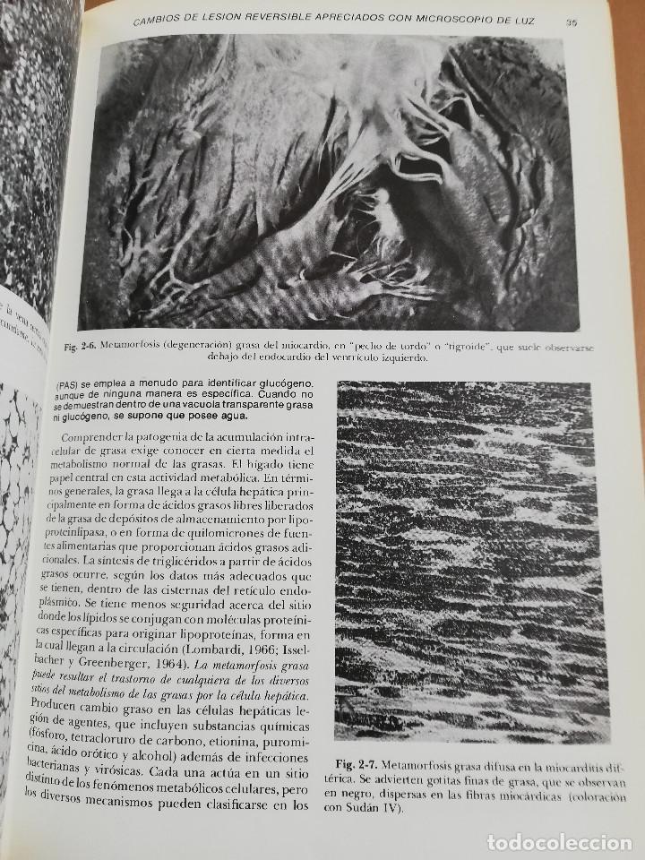 Libros de segunda mano: PATOLOG&Iacute;A ESTRUCTURAL Y FUNCIONAL (DR. STANLEY L. ROBBINS) - Foto 21