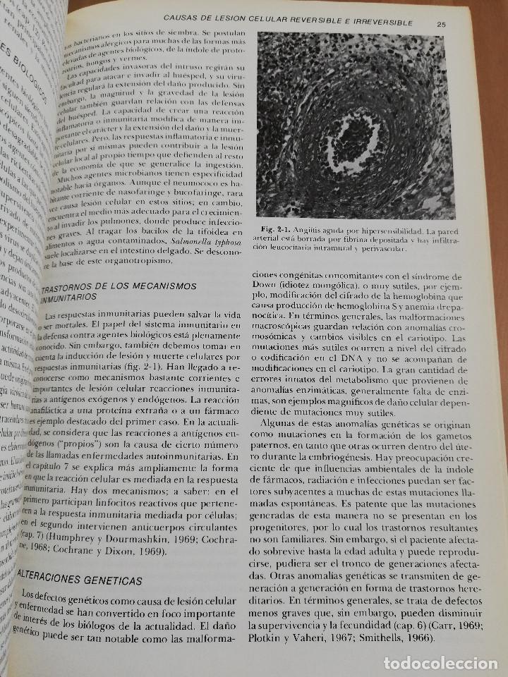Libros de segunda mano: PATOLOG&Iacute;A ESTRUCTURAL Y FUNCIONAL (DR. STANLEY L. ROBBINS) - Foto 22