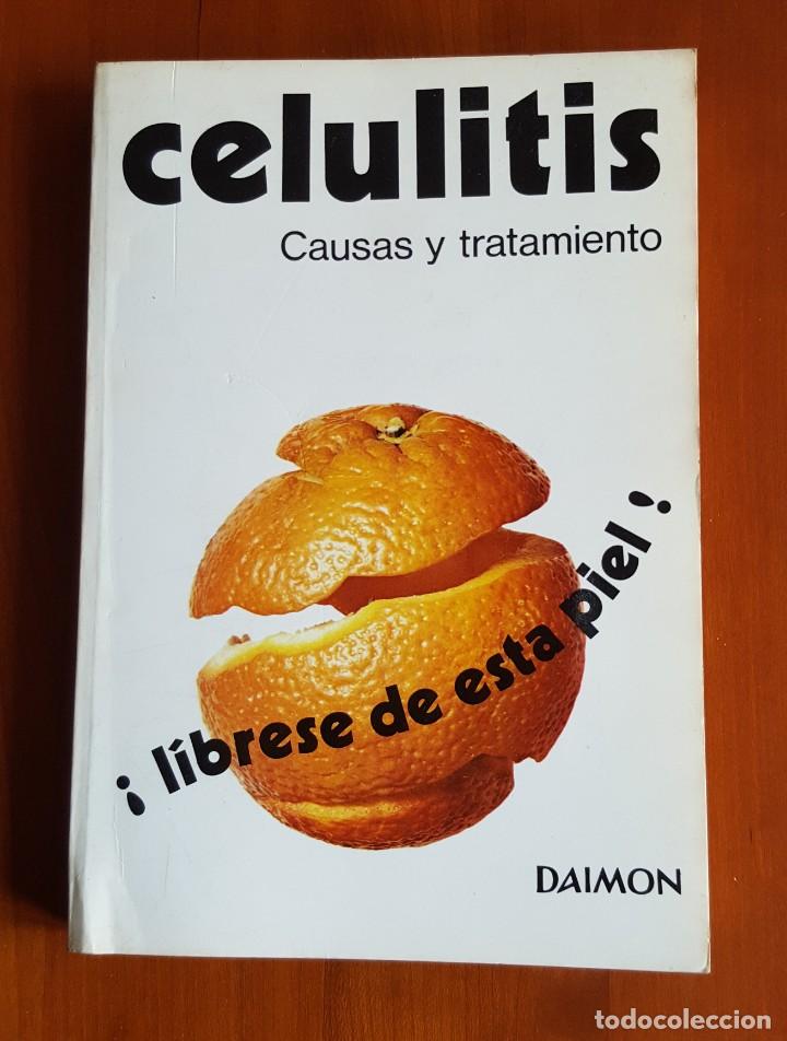 Libros de segunda mano: CELULITIS CAUSAS Y TRATAMIENTO - Foto 1