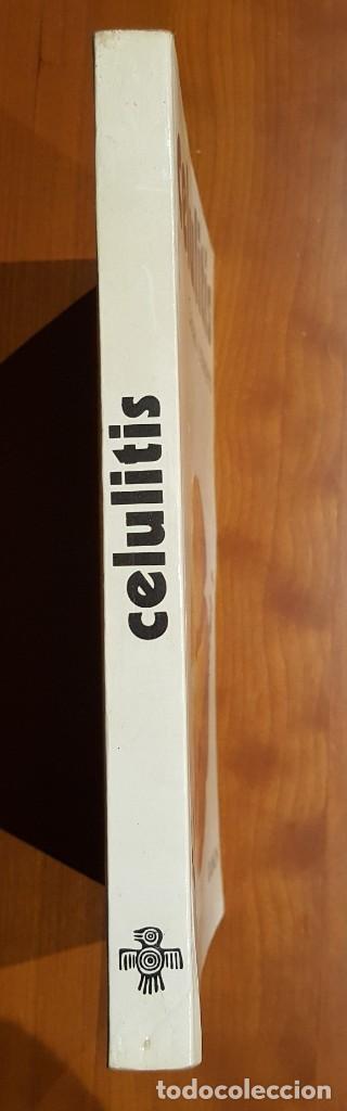 Libros de segunda mano: CELULITIS CAUSAS Y TRATAMIENTO - Foto 3