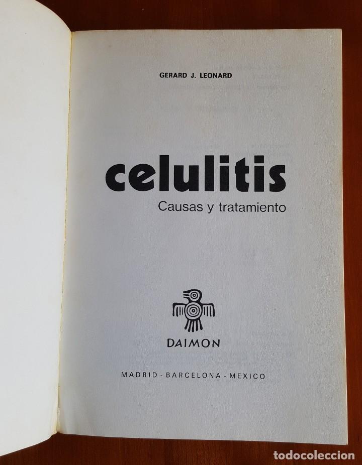 Libros de segunda mano: CELULITIS CAUSAS Y TRATAMIENTO - Foto 4