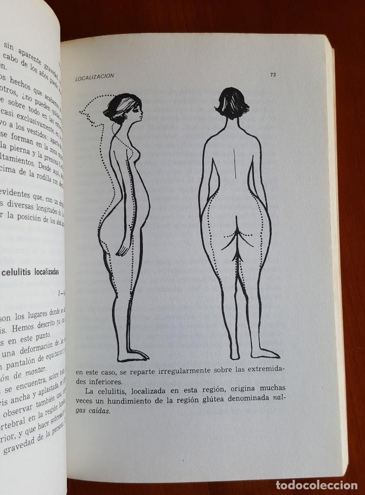 Libros de segunda mano: CELULITIS CAUSAS Y TRATAMIENTO - Foto 10