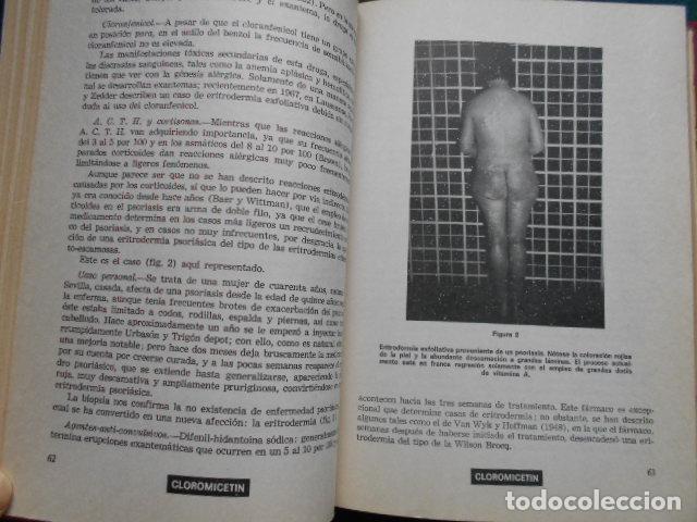Libros de segunda mano: Alergia a medicamentos E. Lopez Botet 1&ordm; simposi&oacute;n - Foto 4