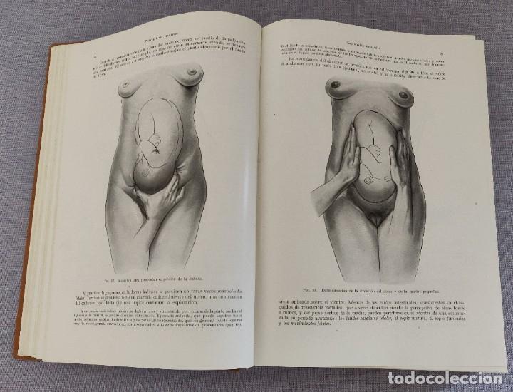 Libros de segunda mano: Libro Tratado de Obstetricia. - Foto 5