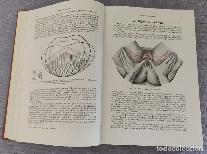 Libros de segunda mano: Libro Tratado de Obstetricia. - Foto 6
