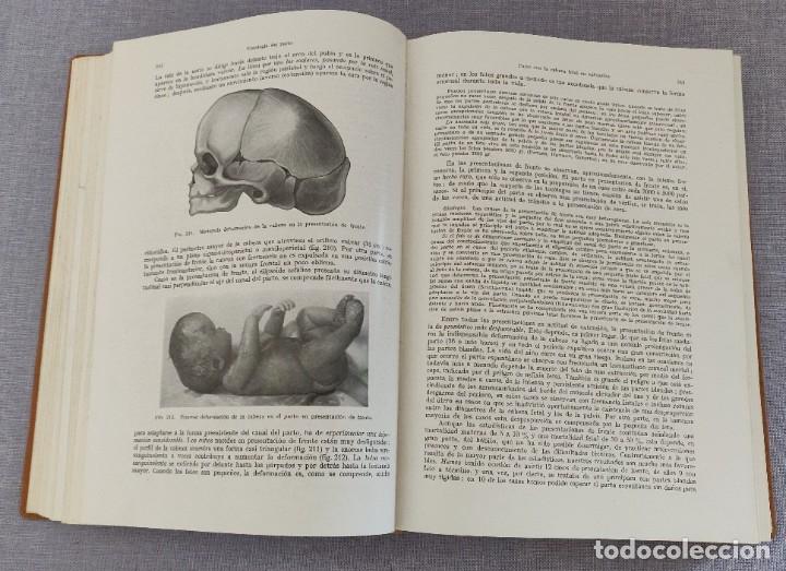 Libros de segunda mano: Libro Tratado de Obstetricia. - Foto 7