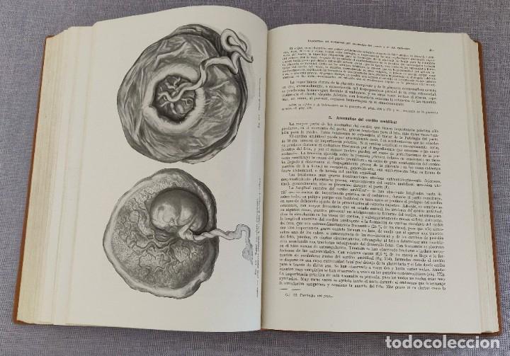 Libros de segunda mano: Libro Tratado de Obstetricia. - Foto 9