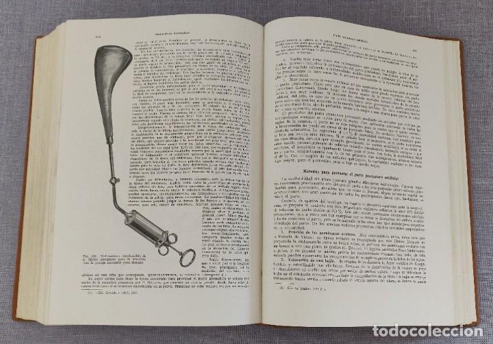 Libros de segunda mano: Libro Tratado de Obstetricia. - Foto 11