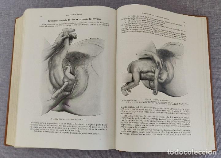 Libros de segunda mano: Libro Tratado de Obstetricia. - Foto 12