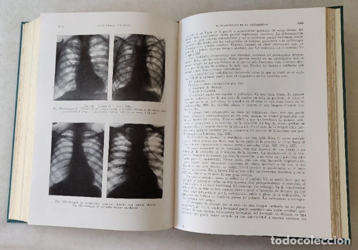 Libros de segunda mano: Libro Medicina Interna - Foto 5
