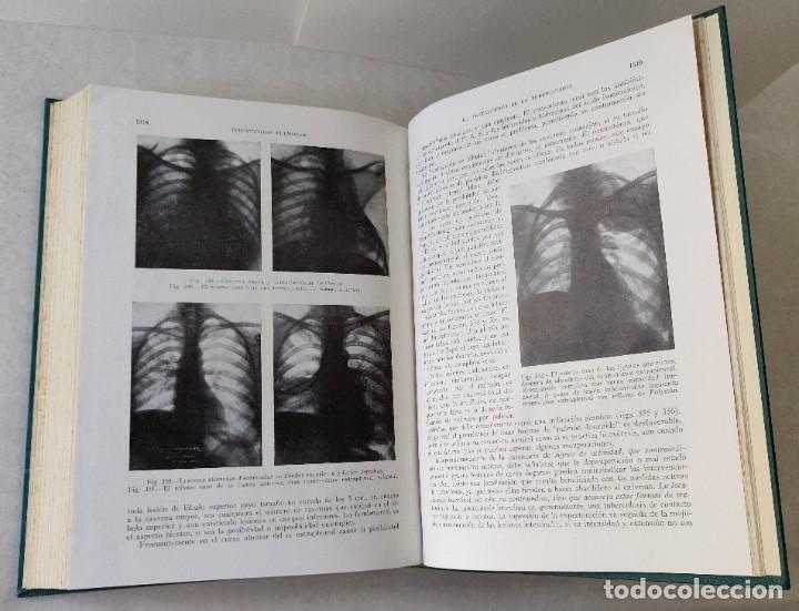 Libros de segunda mano: Libro Medicina Interna - Foto 6